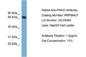 WB Suggested Anti-PRKCI  Antibody Titration: 0. (PKC iota antibody  (Middle Region))