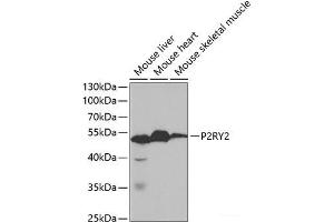 Western blot analysis of extracts of various cell lines using P2RY2 Polyclonal Antibody at dilution of 1:1000. (P2RY2 antibody)