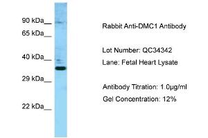 Host: Rabbit Target Name: DMC1 Sample Type: Fetal Heart Antibody Dilution: 1. (DMC1 antibody  (N-Term))