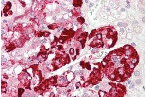 Human Adrenal: Formalin-Fixed, Paraffin-Embedded (FFPE) (SPHKAP antibody  (C-Term))