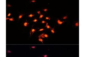 Immunofluorescence analysis of C6 cells using GTF3C4 Polyclonal Antibody at dilution of 1:100 (40x lens). (GTF3C4 antibody)
