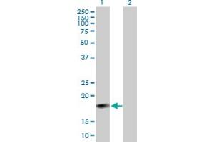 Western Blot analysis of IFNA6 expression in transfected 293T cell line by IFNA6 MaxPab polyclonal antibody. (IFNA6 antibody  (AA 1-189))