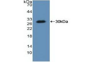 Detection of Recombinant KARS, Human using Polyclonal Antibody to Lysyl tRNA Synthetase (KARS)