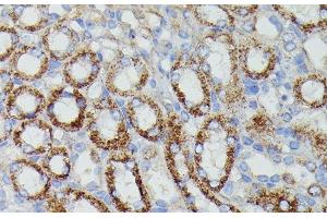 NDUFAB1 antibody