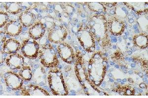 Immunohistochemistry of paraffin-embedded Mouse kidney using NDUFAB1 Polyclonal Antibody at dilution of 1:100 (40x lens). (NDUFAB1 antibody)