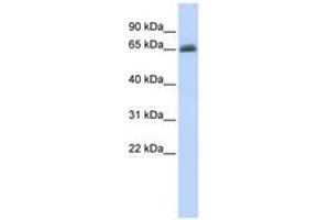 Image no. 1 for anti-UDP Glucuronosyltransferase 2 Family, Polypeptide B15 (UGT2B15) (AA 72-121) antibody (ABIN6740741) (UGT2B15 antibody  (AA 72-121))