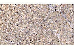 Detection of TF in Porcine Liver Tissue using Polyclonal Antibody to Transferrin (TF) (Transferrin antibody)