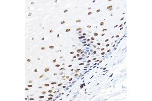 Immunohistochemistry of paraffin-embedded human esophageal using GTF2B Rabbit pAb (ABIN7267370) at dilution of 1:100 (40x lens). (GTF2B antibody  (AA 50-150))