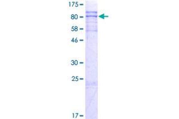 ZNF238 Protein (AA 1-522) (GST tag)