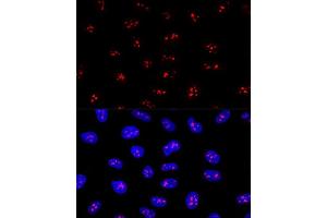 Confocal immunofluorescence analysis of U2OS cells using EBNBP2 Polyclonal Antibody (ABIN6132193, ABIN6139912, ABIN6139913 and ABIN6224909) at dilution of 1:200. (EBNA1BP2 antibody  (AA 1-306))