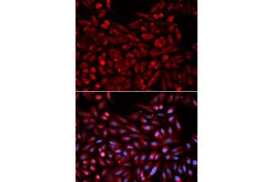 Immunofluorescence analysis of U2OS cells using NR1I3 antibody (ABIN5971021). (NR1I3 antibody)