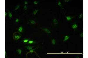 Immunofluorescence of monoclonal antibody to CBX5 on HeLa cell. (CBX5 antibody  (AA 1-191))