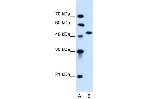 ACVR1 antibody used at 0. (ACVR1 antibody  (N-Term))