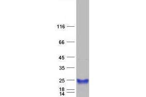 Western Blotting (WB) image for Retinol Binding Protein 4, Plasma (RBP4) protein (Myc-DYKDDDDK Tag) (ABIN2730635)