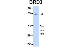 Western Blotting (WB) image for anti-Bromodomain Containing 3 (BRD3) (Middle Region) antibody (ABIN2775791)