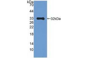 Detection of Recombinant MAPK10, Human using Polyclonal Antibody to Mitogen Activated Protein Kinase 10 (MAPK10) (MAPK10 antibody  (AA 88-332))