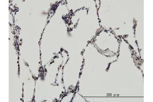Image no. 3 for anti-Enhancer of Rudimentary Homolog (ERH) (AA 1-105) antibody (ABIN598672) (ERH antibody  (AA 1-105))