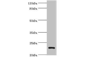 Western blot All lanes: APOBEC3C antibody at 3 μg/mL + K562 whole cell lysate Secondary Goat polyclonal to rabbit IgG at 1/10000 dilution Predicted band size: 23 kDa Observed band size: 23 kDa (APOBEC3C antibody  (AA 1-190))
