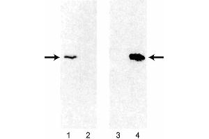 Western blot analysis of Bcl-2 expression using 3F11 and 6C8 monoclonal antibodies in human and mouse thymocytes. (Bcl-2 antibody)