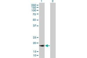 Western Blot analysis of IFNA5 expression in transfected 293T cell line by IFNA5 MaxPab polyclonal antibody.