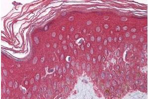 Immunohistochemistry (Formalin-fixed Paraffin-embedded Sections) (IHC (fp)) image for anti-Fibroblast Growth Factor Receptor 1 (FGFR1) (AA 179-195) antibody (ABIN790693)