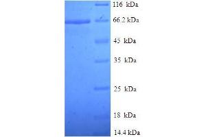 SDS-PAGE (SDS) image for Tubulin beta-2A Chain (TBB2A) (AA 1-445), (full length) protein (His-SUMO Tag) (ABIN5710564)