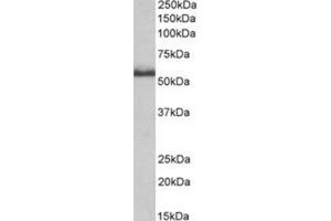 AP31402PU-N CD120b antibody staining of Rat Spinal Cord lysate at 0. (TNFRSF1B antibody  (Internal Region))