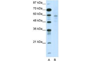 WB Suggested Anti-DMAP1 Antibody Titration:  2. (DMAP1 antibody  (N-Term))