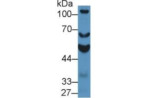 Western Blotting (WB) image for anti-Aldehyde Dehydrogenase 1 Family, Member A2 (ALDH1A2) (AA 1-422) antibody (ABIN7435901)
