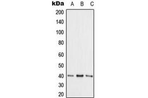 Western blot analysis of Adenosine Kinase expression in HepG2 (A), NIH3T3 (B), PC12 (C) whole cell lysates. (ADK antibody  (N-Term))