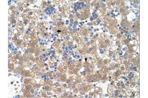 Image no. 1 for anti-Peroxisomal Biogenesis Factor 3 (PEX3) (AA 31-80) antibody (ABIN321040) (PEX3 antibody  (AA 31-80))