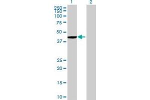 Western Blot analysis of ZNF707 expression in transfected 293T cell line by ZNF707 MaxPab polyclonal antibody. (ZNF707 antibody  (AA 1-369))