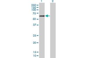 Western Blot analysis of GALNT14 expression in transfected 293T cell line by GALNT14 MaxPab polyclonal antibody. (GALNT14 antibody  (AA 1-552))