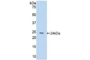 Detection of Recombinant CTSG, Rat using Polyclonal Antibody to Cathepsin G (CTSG) (Cathepsin G antibody  (AA 51-250))