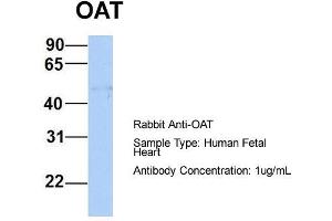 Host:  Rabbit  Target Name:  OAT  Sample Type:  Human Fetal Heart  Antibody Dilution:  1. (OAT antibody  (Middle Region))