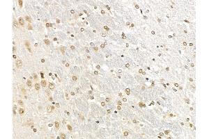 ABIN7094789 and ABIN7098840 at 1/100 staining Rat brain tissue by IHC-P. (IRF8 antibody  (Internal Region))