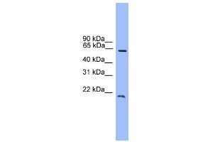 WB Suggested Anti-DACH1 Antibody Titration:  0. (DACH1 antibody  (C-Term))