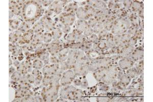 Immunoperoxidase of monoclonal antibody to HIPK1 on formalin-fixed paraffin-embedded human salivary gland. (HIPK1 antibody  (AA 330-430))
