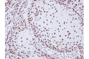 IHC-P Image Immunohistochemical analysis of paraffin-embedded Cal27 xenograft, using SART1, antibody at 1:500 dilution. (SART1 antibody  (Internal Region))