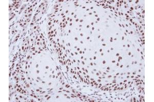 IHC-P Image Immunohistochemical analysis of paraffin-embedded Cal27 xenograft, using SART1, antibody at 1:500 dilution. (SART1 antibody  (Internal Region))