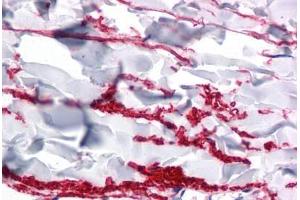 Human Skin, Dermis: Formalin-Fixed, Paraffin-Embedded (FFPE) (FAM59A antibody  (C-Term))