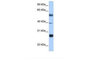 Image no. 1 for anti-MAX Dimerization Protein 3 (MXD3) (N-Term) antibody (ABIN6737887) (MXD3 antibody  (N-Term))