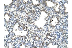 Immunohistochemistry (IHC) image for anti-Solute Carrier Family 26, Member 5 (Prestin) (SLC26A5) (Middle Region) antibody (ABIN310566) (SLC26A5 antibody  (Middle Region))