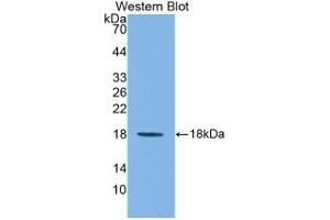 Detection of Recombinant IL1F9, Mouse using Monoclonal Antibody to Interleukin 1 Family, Member 9 (IL1F9) (IL1F9 antibody  (AA 5-149))