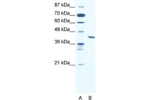 Human Jurkat; WB Suggested Anti-ZNF621 Antibody Titration: 2. (ZNF621 antibody  (Middle Region))