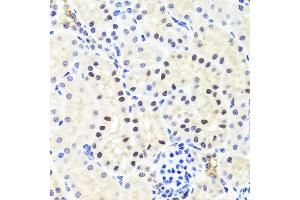 Immunohistochemistry of paraffin-embedded mouse kidney using RUNX1 antibody at dilution of 1:100 (x40 lens).