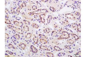 Formalin-fixed and paraffin embedded human kidney labeled with Rabbit Anti Phospho-HER2 (Tyr686) Polyclonal Antibody, Unconjugated (ABIN752398) at 1:200 followed by conjugation to the secondary antibody and DAB staining