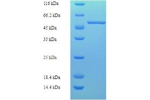 SDS-PAGE (SDS) image for ATPase, H+ Transporting, Lysosomal Accessory Protein 2 (ATP6AP2) (AA 17-350) protein (His-SUMO Tag) (ABIN5709109) (ATP6AP2 Protein (AA 17-350) (His-SUMO Tag))