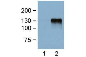 1:1000 (1μg/mL) Ab dilution probed against HEK293 cells transfected with DYKDDDDK-tagged protein vector, untransfected (1) and transfected (2) (DYKDDDDK Tag antibody)