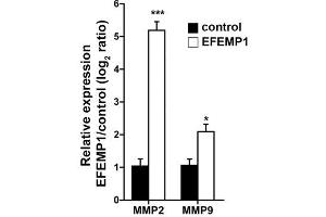 Bioactivity measured with Activity Assay (FBLN3 Protein (Transcript Variant 1) (Myc-DYKDDDDK Tag))